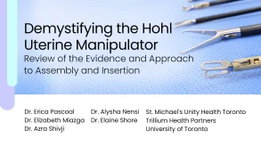Demystifying the Hohl Uterine Manipulator: Review of the Evidence and Approach to Assembly and Insertion 50 Demystifying the Hohl Uterine Manipulator: Review of the Evidence and Approach to Assembly and Insertion