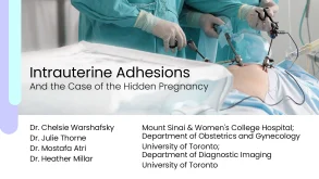 Intrauterine Adhesions and the Case of the Hidden Pregnancy 55 Intrauterine Adhesions and the Case of the Hidden Pregnancy