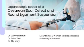 Title card for the video "Laparoscopic Repair of a Cesarean Scar Defect and Round Ligament Suspension"