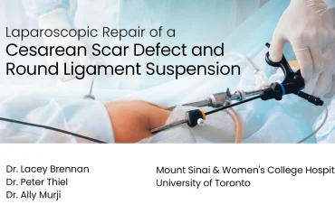 Title card for the video "Laparoscopic Repair of a Cesarean Scar Defect and Round Ligament Suspension"