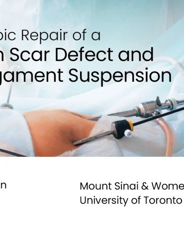 Title card for the video "Laparoscopic Repair of a Cesarean Scar Defect and Round Ligament Suspension"