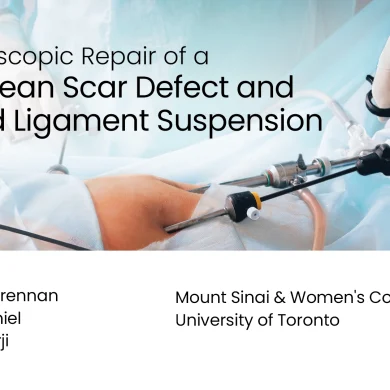 Title card for the video "Laparoscopic Repair of a Cesarean Scar Defect and Round Ligament Suspension"