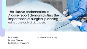 The Elusive endometriosis: A case report demonstrating the importance of surgical planning using transvaginal ultrasound 54 The Elusive endometriosis: A case report demonstrating the importance of surgical planning using transvaginal ultrasound