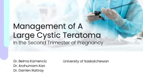 Management of a Large Cystic Teratoma in the Second Trimester of Pregnancy