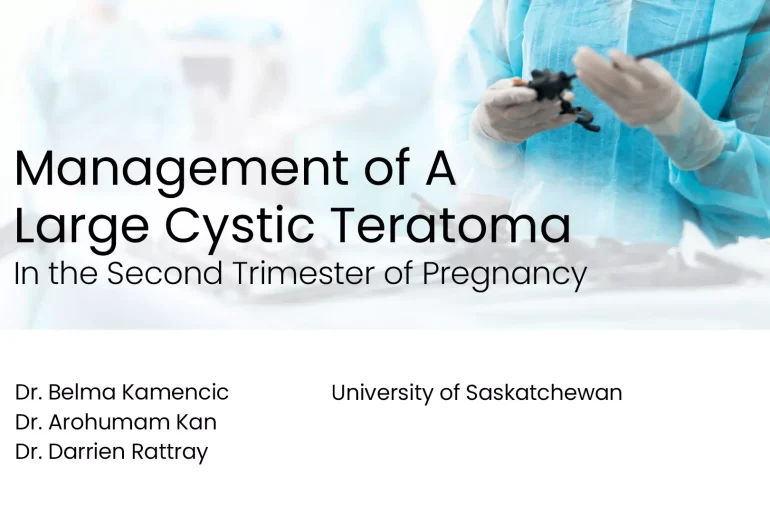 Management of a Large Cystic Teratoma in the Second Trimester of Pregnancy