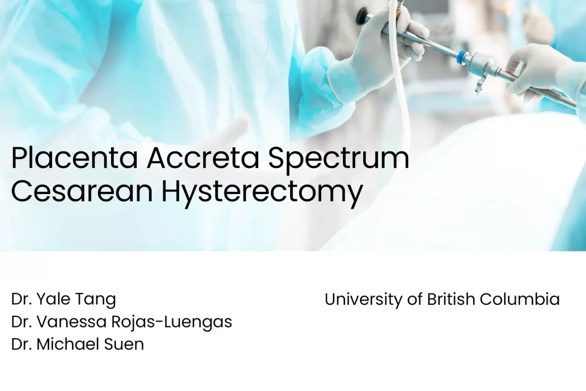 Placenta Accreta Spectrum Cesarean Hysterectomy