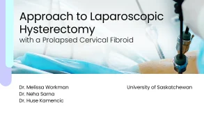 Approach to Laparoscopic Hysterectomy with a Prolapsed Cervical Fibroid 14