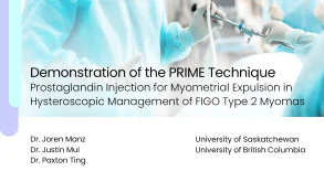 Demonstration of the PRIME Technique: Prostaglandin Injection for Myometrial Expulsion in Hysteroscopic Management of FIGO Type 2 Myomas 21