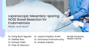 Laparoscopic Mesentery-sparing NOSE Bowel Resection for Endometriosis: When and How? 24