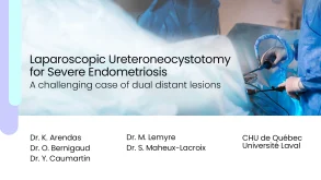Laparoscopic ureteroneocystotomy for severe endometriosis: a challenging case of dual distant lesions 19