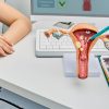 Demystifying Myths for Endometriosis Treatment 31 A nurse and doctor discuss endometriosis symptoms by using a physical model of the uterus