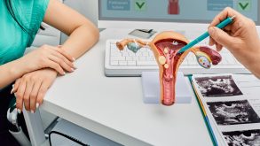 Demystifying Myths for Endometriosis Treatment 18 A nurse and doctor discuss endometriosis symptoms by using a physical model of the uterus