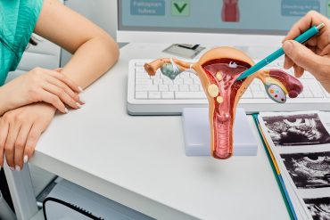 A nurse and doctor discuss endometriosis symptoms by using a physical model of the uterus