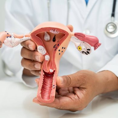 Doctor holding model of uterus to show potential effects of endometriosis on fertility