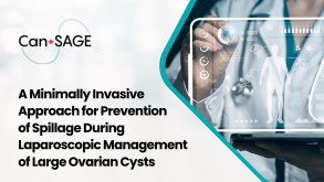 Reducing Intraoperative Spillage During Laparoscopic Ovarian Cystectomy 14