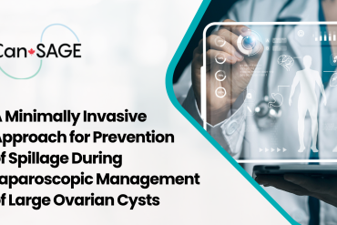 Reducing Intraoperative Spillage During Laparoscopic Ovarian Cystectomy 23