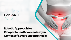 Robotic Approach for Retoperitoneal Myomectomy in Context of Severe Endometriosis 21